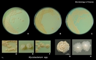 mycobacterium